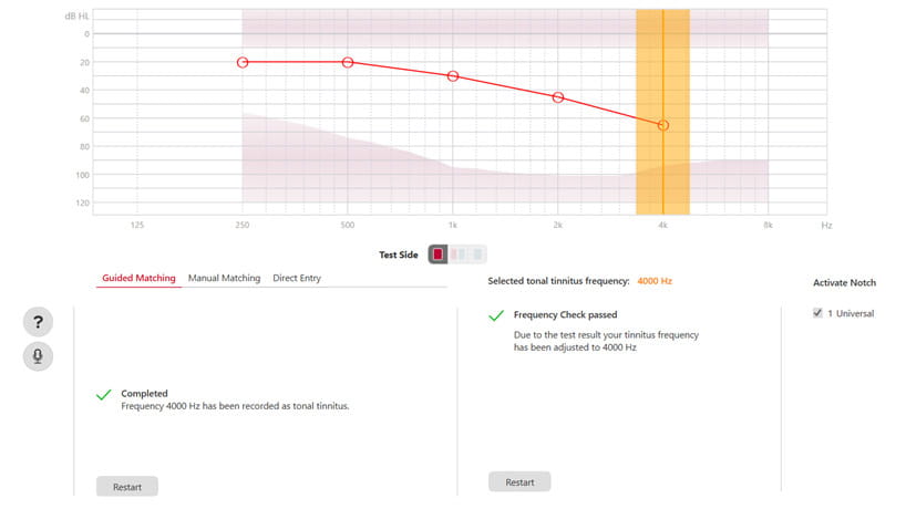 tinnitus notch therapy